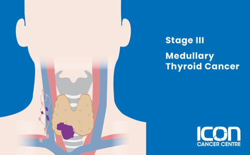 Stage III medullary thyroid cancer illustration